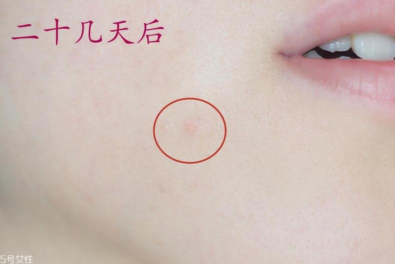 雅詩蘭黛晶透沁白防曬搖搖乳成膜快嗎？適合油痘皮嗎？