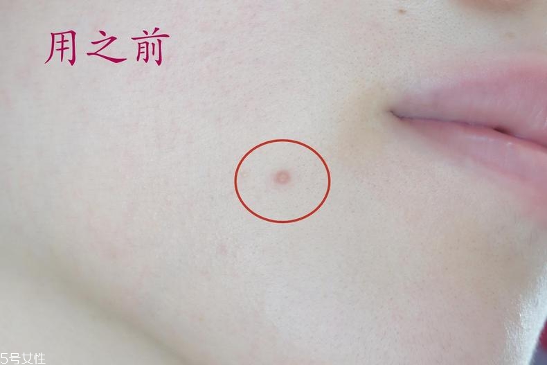雅詩蘭黛晶透沁白防曬搖搖乳成膜快嗎？適合油痘皮嗎？