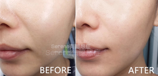 dermawand逆齡射頻注氧棒怎么用？