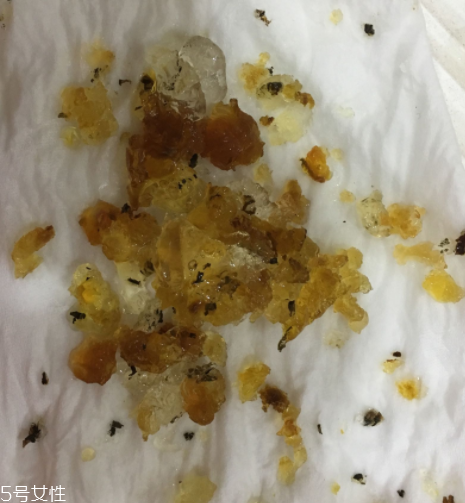桃膠能和雞蛋一起吃嗎？桃膠配雞蛋可以嗎？