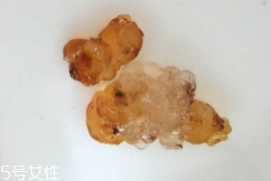 桃膠可以用開水泡嗎？用開水泡桃膠好嗎？