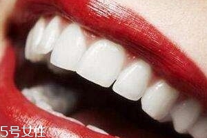 冷光美白會反彈嗎？冷光美白心得