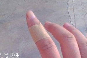 創(chuàng)可貼可以消腫嗎？創(chuàng)可貼有消腫功效嗎？