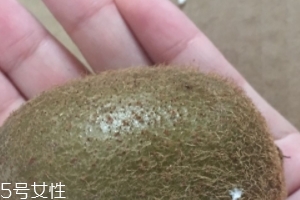 綠心獼猴桃含葉酸嗎？綠心獼猴桃里面有葉酸嗎？