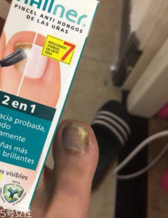 灰甲清有副作用嗎？灰甲清有哪些副作用？