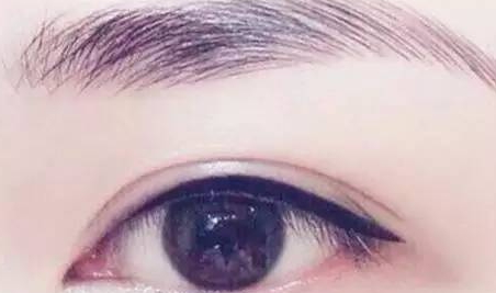 提眉和雙眼皮一起做嗎？提眉和雙眼皮要隔開(kāi)多久