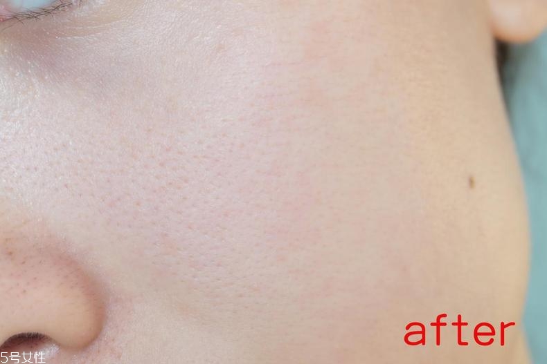 radha beauty vc精華白天能用嗎？敏感肌能用嗎？