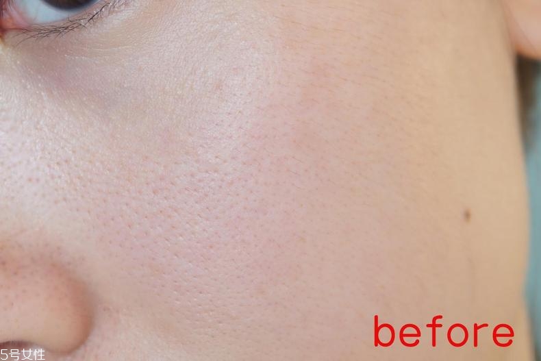 radha beauty vc精華白天能用嗎？敏感肌能用嗎？