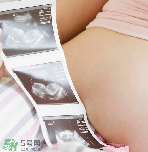 頭胎雙胞胎還能生二胎嗎？雙胞胎家庭能要二胎嗎？