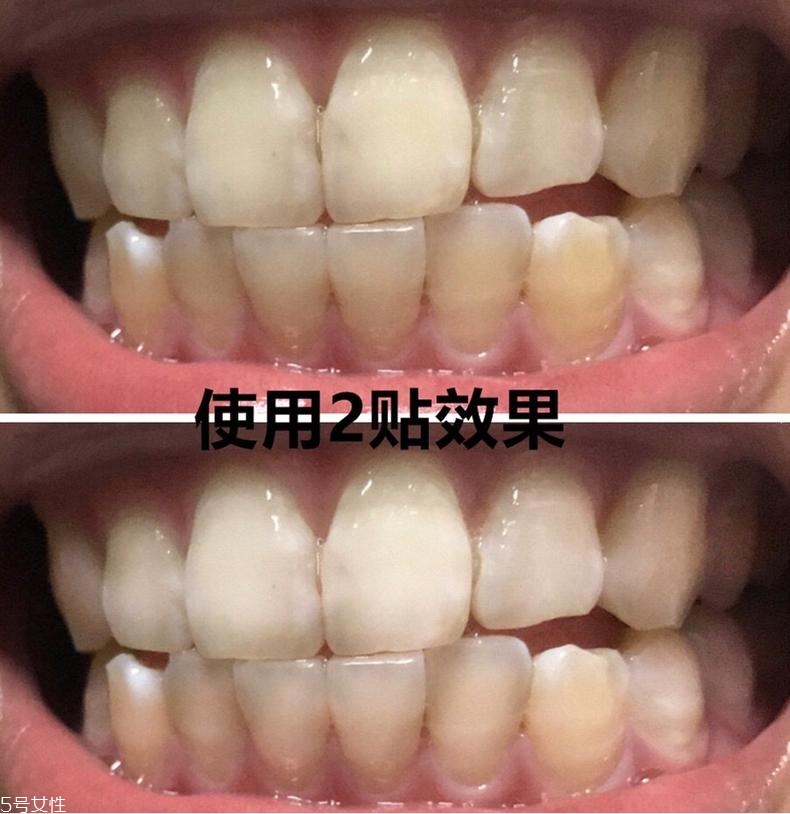 佳潔士美白牙貼貼多久有效？佳潔士美白牙貼使用感受