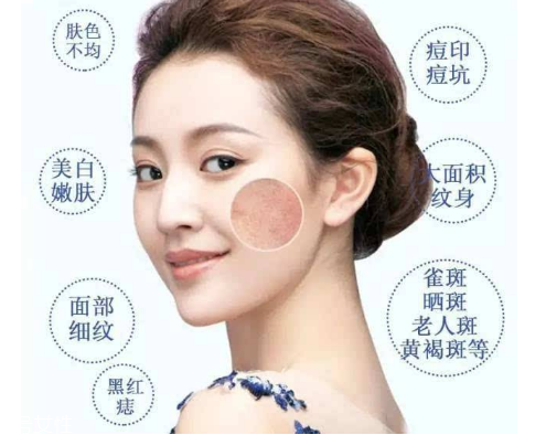 皮秒會反黑嗎 這是正?，F(xiàn)象