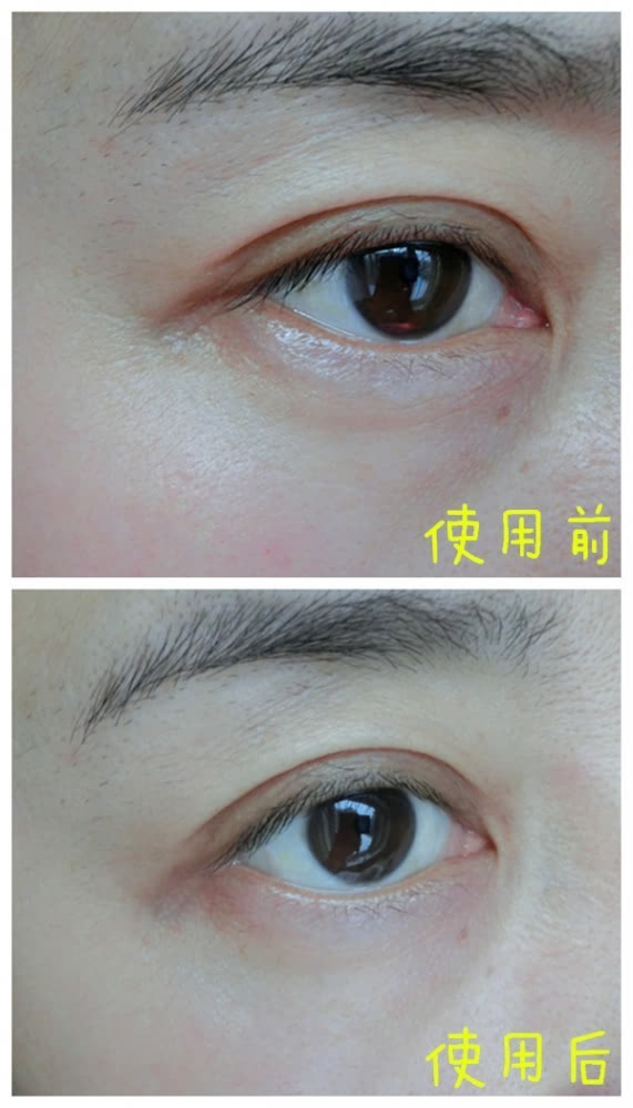 VIIcode夜間氧眼貼抗老效果怎么樣？VIIcode眼膜使用測評(píng)