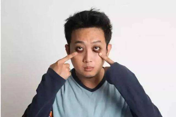 黑眼圈很?chē)?yán)重怎么回事 黑眼圈很?chē)?yán)重是得病了嗎