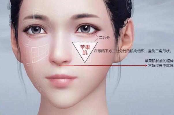 蘋果肌復位術(shù)怎么做 蘋果肌復位術(shù)可以保持多久