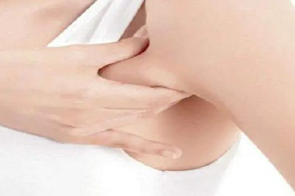 副乳切除手術(shù)是全麻還是局麻 副乳切除手術(shù)后多久可以正?；顒?dòng)
