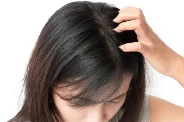 干性頭發(fā)怎么護(hù)理 干性頭發(fā)用有硅油的好一點(diǎn)還是用無(wú)硅油好
